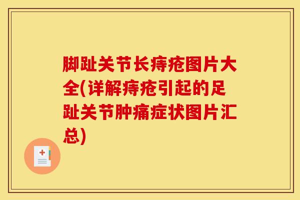 脚趾关节长痔疮图片大全(详解痔疮引起的足趾关节肿痛症状图片汇总) 脚趾关节长痔疮图片大全(详解痔疮引起的足趾关节肿痛症状图片汇总)