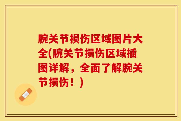 腕关节损伤区域图片大全(腕关节损伤区域插图详解，全面了解腕关节损伤！)