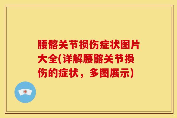 腰髂关节损伤症状图片大全(详解腰髂关节损伤的症状，多图展示)