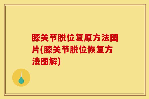 膝关节脱位复原方法图片(膝关节脱位恢复方法图解)