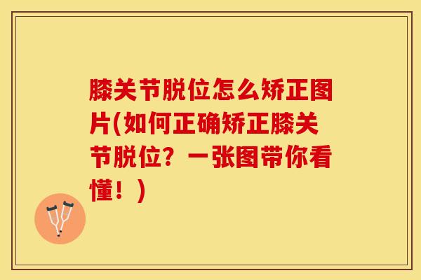 膝关节脱位怎么矫正图片(如何正确矫正膝关节脱位？一张图带你看懂！)