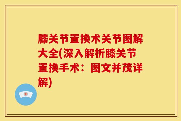 膝关节置换术关节图解大全(深入解析膝关节置换手术：图文并茂详解)