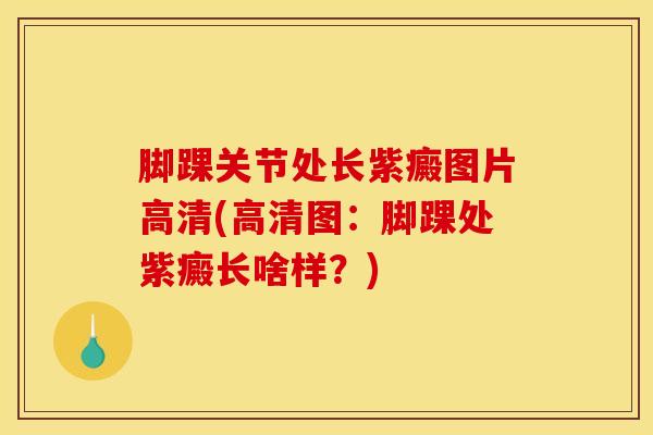 脚踝关节处长紫癜图片高清(高清图：脚踝处紫癜长啥样？)
