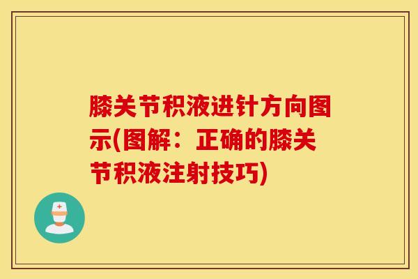 膝关节积液进针方向图示(图解：正确的膝关节积液注射技巧)