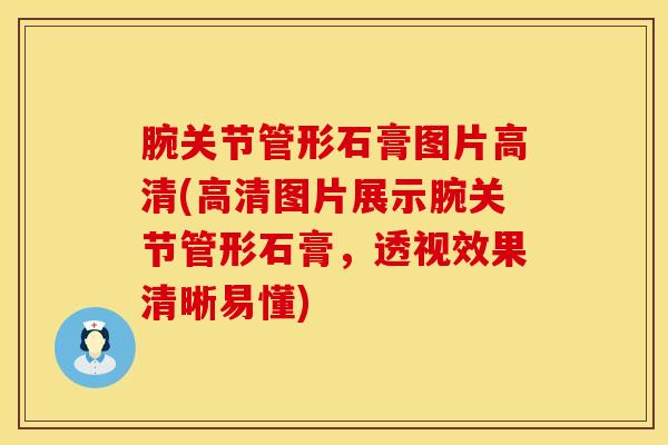 腕关节管形石膏图片高清(高清图片展示腕关节管形石膏，透视效果清晰易懂)