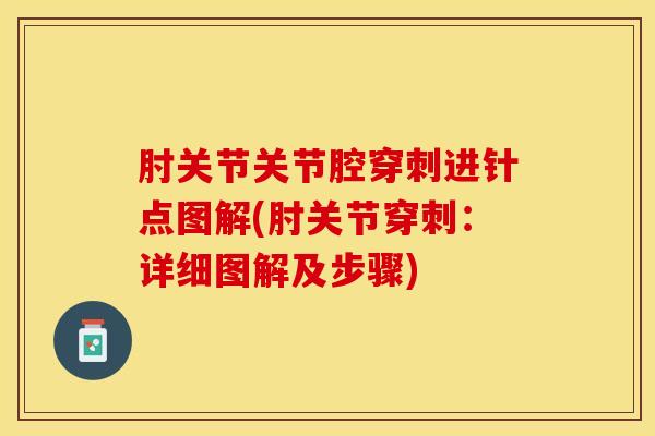 肘关节关节腔穿刺进针点图解(肘关节穿刺：详细图解及步骤)