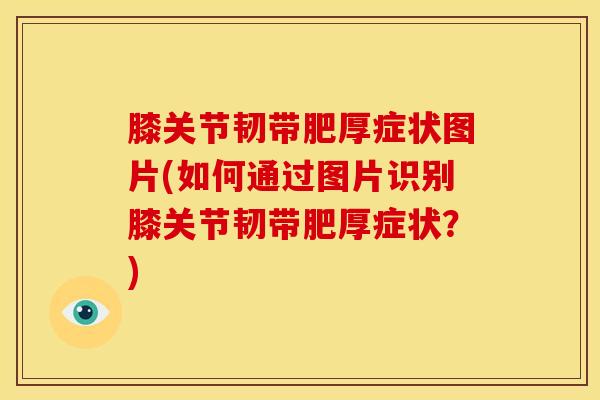 膝关节韧带肥厚症状图片(如何通过图片识别膝关节韧带肥厚症状？)