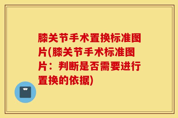膝关节手术置换标准图片(膝关节手术标准图片:判断是否需要进行置换的依据) 膝关节手术置换标准图片(膝关节手术标准图片:判断是否需要进行置换的依据)