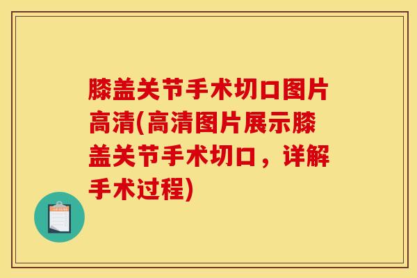 膝盖关节手术切口图片高清(高清图片展示膝盖关节手术切口，详解手术过程)