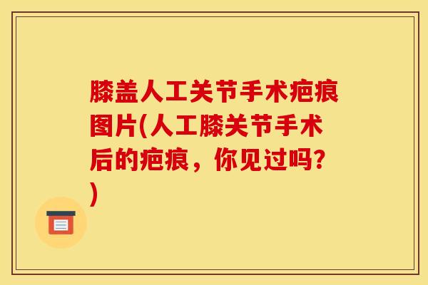 膝盖人工关节手术疤痕图片(人工膝关节手术后的疤痕，你见过吗？)