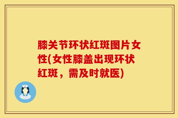 膝关节环状红斑图片女性(女性膝盖出现环状红斑，需及时就医)
