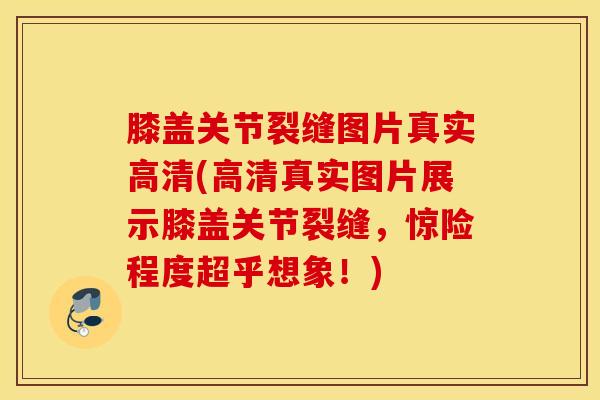 膝盖关节裂缝图片真实高清(高清真实图片展示膝盖关节裂缝,惊险程度超乎想象!) 膝盖关节裂缝图片真实高清(高清真实图片展示膝盖关节裂缝,惊险程度超乎想象!)