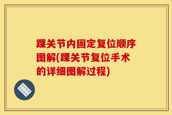 踝关节内固定复位顺序图解(踝关节复位手术的详细图解过程)