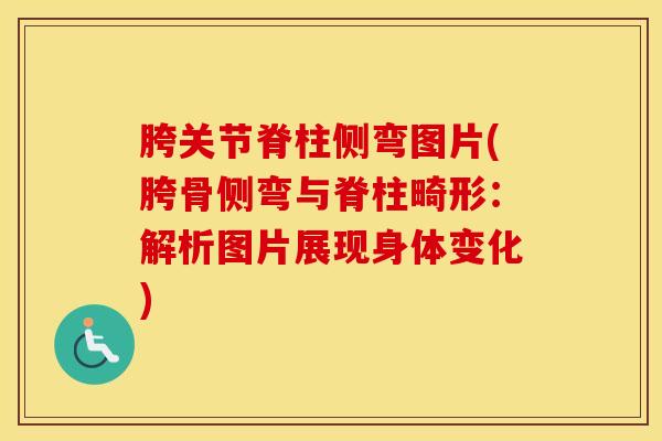 胯关节脊柱侧弯图片(胯骨侧弯与脊柱畸形：解析图片展现身体变化)