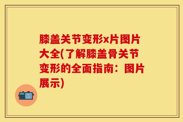 膝盖关节变形x片图片大全(了解膝盖骨关节变形的全面指南:图片展示) 膝盖关节变形x片图片大全(了解膝盖骨关节变形的全面指南:图片展示)