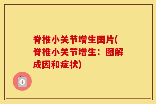 脊椎小关节增生图片(脊椎小关节增生:图解成因和症状) 脊椎小关节增生图片(脊椎小关节增生:图解成因和症状)