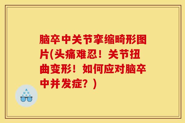脑卒中关节挛缩畸形图片(头痛难忍！关节扭曲变形！如何应对脑卒中并发症？)