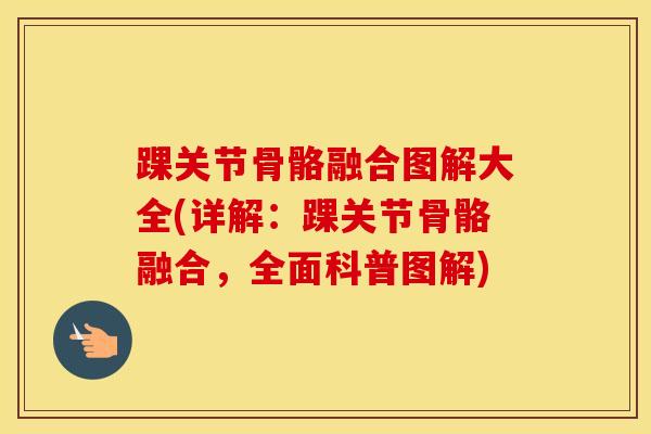 踝关节骨骼融合图解大全(详解:踝关节骨骼融合,全面科普图解) 踝关节骨骼融合图解大全(详解:踝关节骨骼融合,全面科普图解)