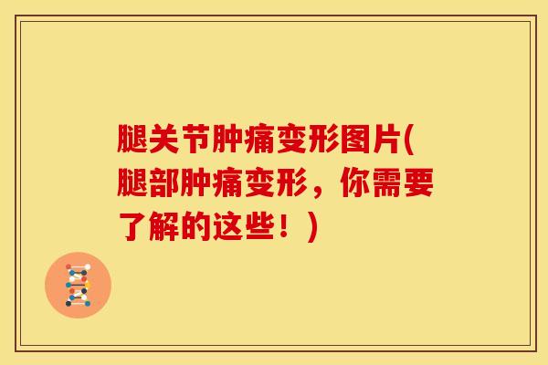 腿关节肿痛变形图片(腿部肿痛变形,你需要了解的这些!) 腿关节肿痛变形图片(腿部肿痛变形,你需要了解的这些!)
