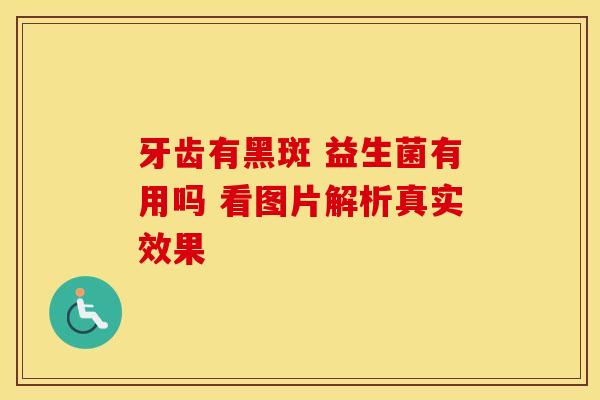 牙齿有黑斑 益生菌有用吗 看图片解析真实效果 牙齿有黑斑 益生菌有用吗 看图片解析真实效果